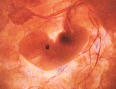 foto de embrião humano