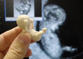 Modelo de feto de 12 semanas gerado pela tecnologia de prototipagem rápida.