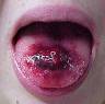 piercing na lingua inflamada